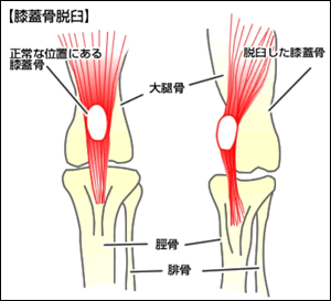 guide_orthopedics01